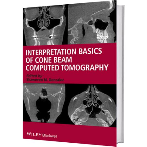 Cone beam computed tomography: basics and applications in .
